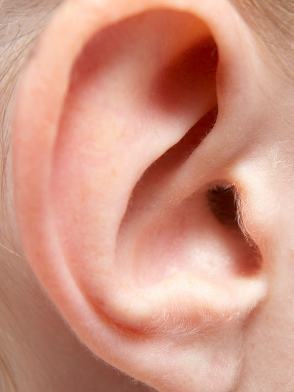 Understanding Hearing Loss